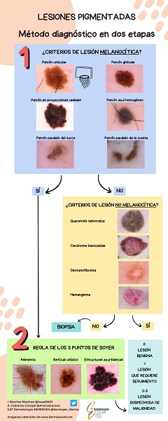Dermatoscopia. Lesiones pigmentadas. Método diagnóstico en dos etapas