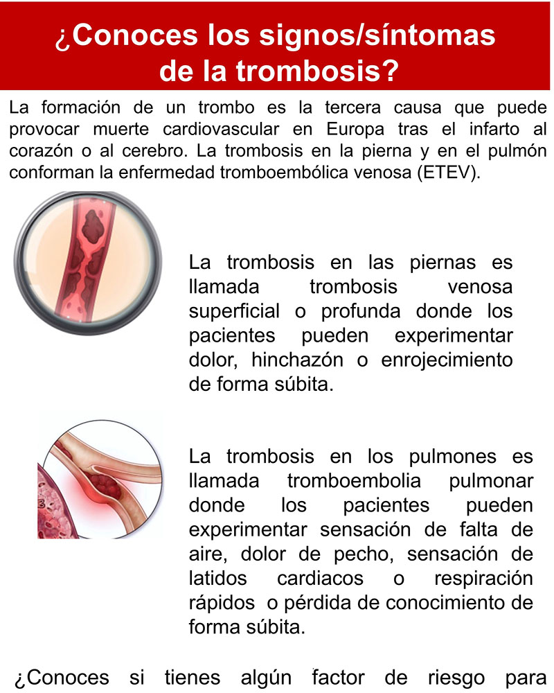 ¿Conoces los síntomas de la trombosis?